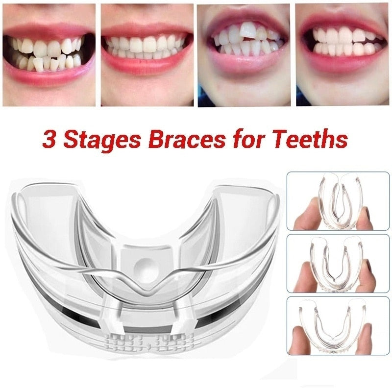 Trainer Teeth Retainer